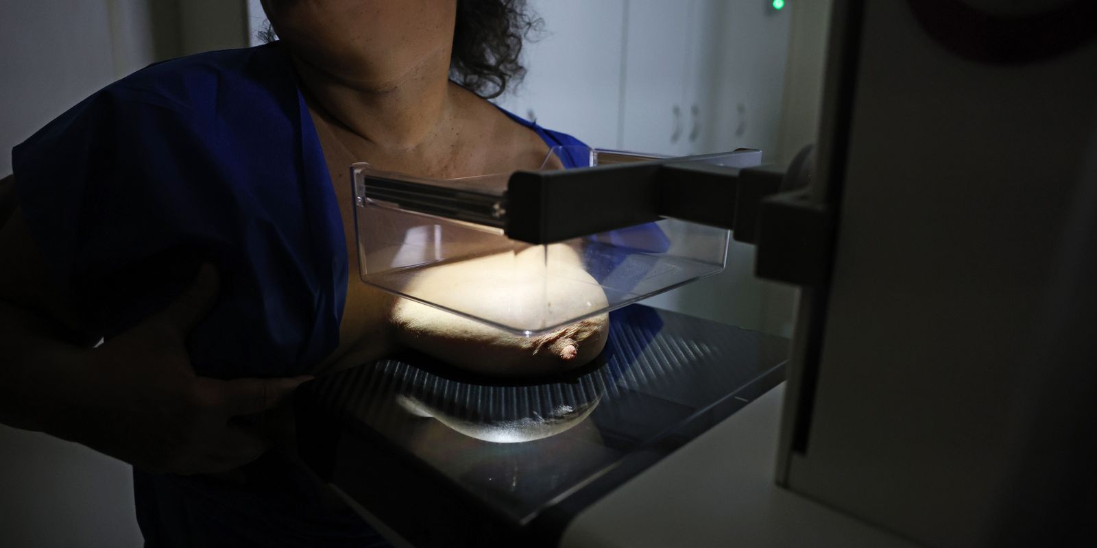 ANS propõe cobertura irrestrita de mamografia digital por planos de saúde