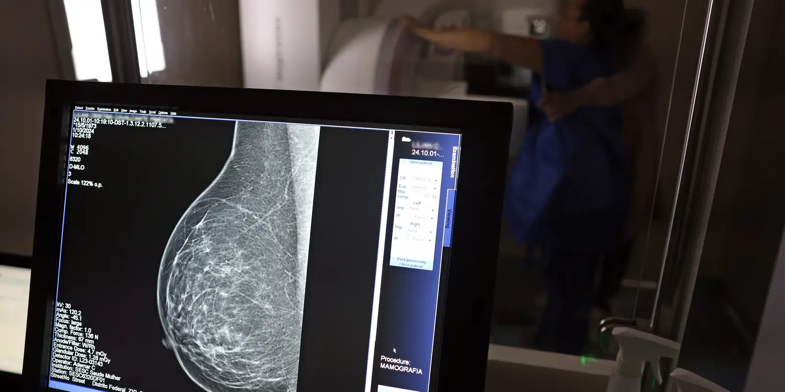 Planos de saúde devem cobrir mamografia digital sem limitação de idade